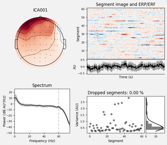 _images/train_network_eeg_1_100.png