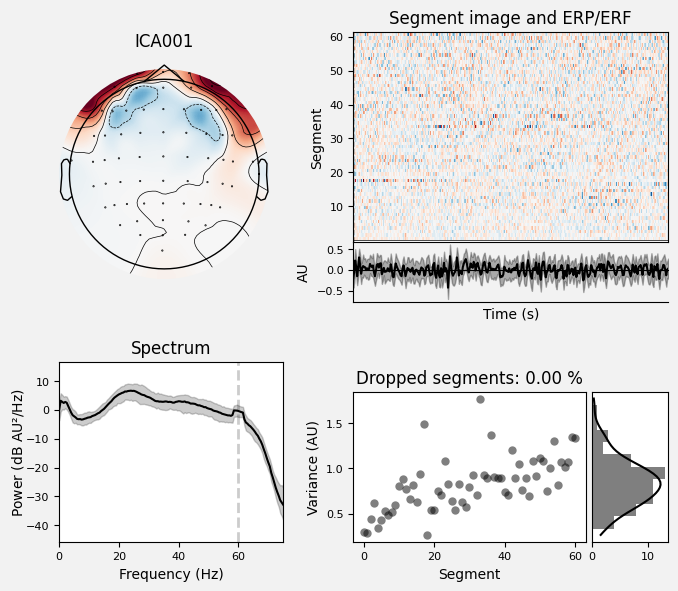 _images/train_network_eeg_1_105.png