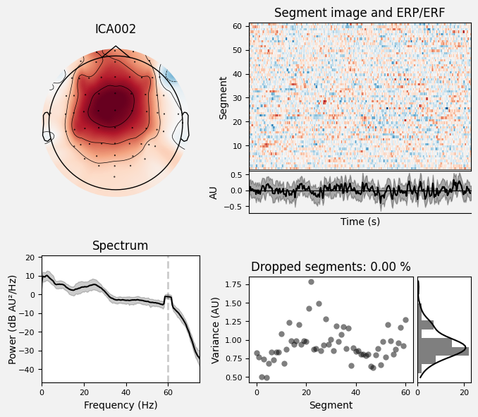 _images/train_network_eeg_1_106.png