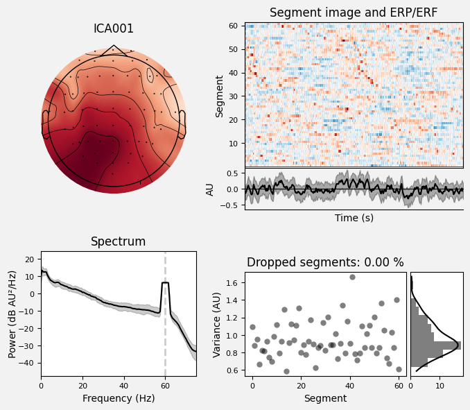 _images/train_network_eeg_1_112.png