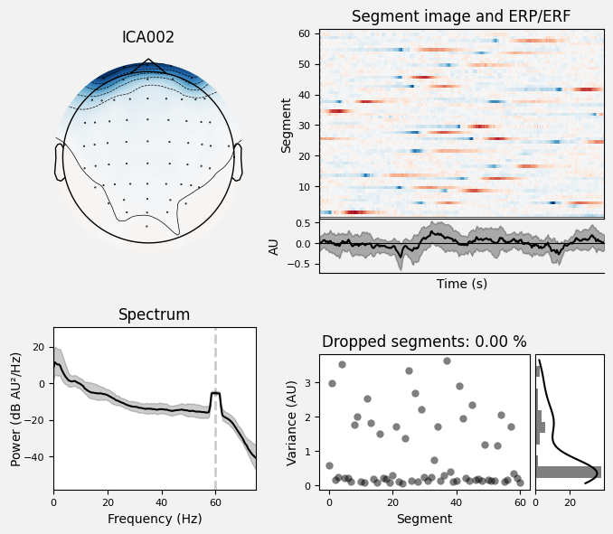 _images/train_network_eeg_1_113.png