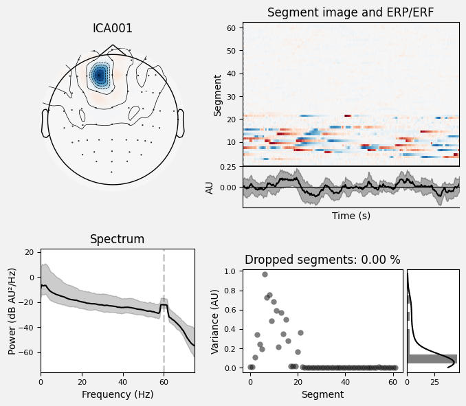 _images/train_network_eeg_1_117.png