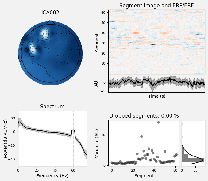 _images/train_network_eeg_1_118.png