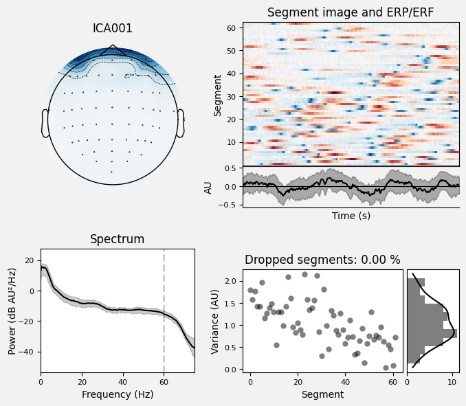 _images/train_network_eeg_1_122.png