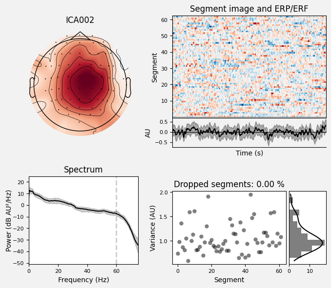 _images/train_network_eeg_1_123.png