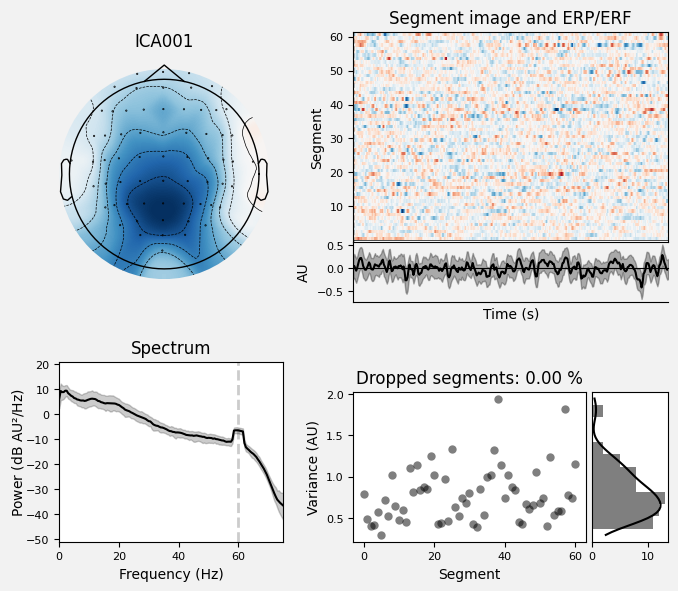 _images/train_network_eeg_1_127.png