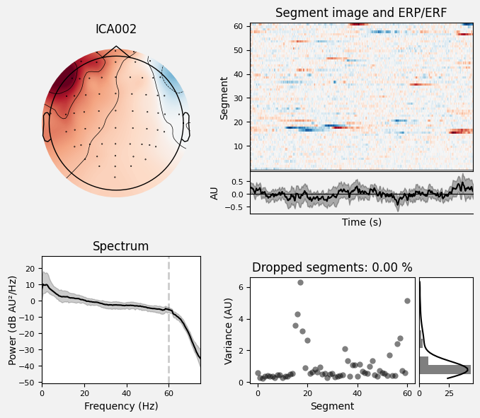 _images/train_network_eeg_1_128.png