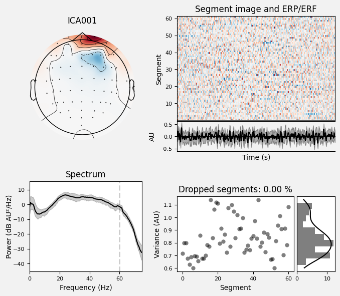 _images/train_network_eeg_1_134.png