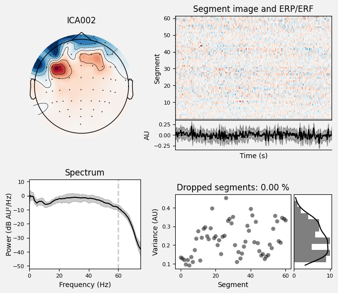 _images/train_network_eeg_1_135.png