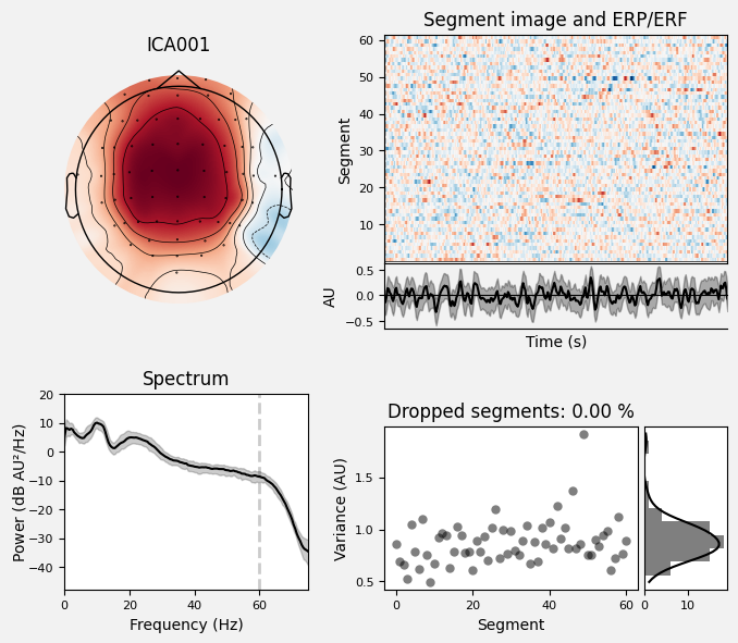 _images/train_network_eeg_1_141.png