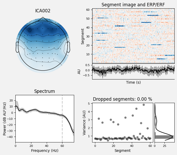 _images/train_network_eeg_1_142.png