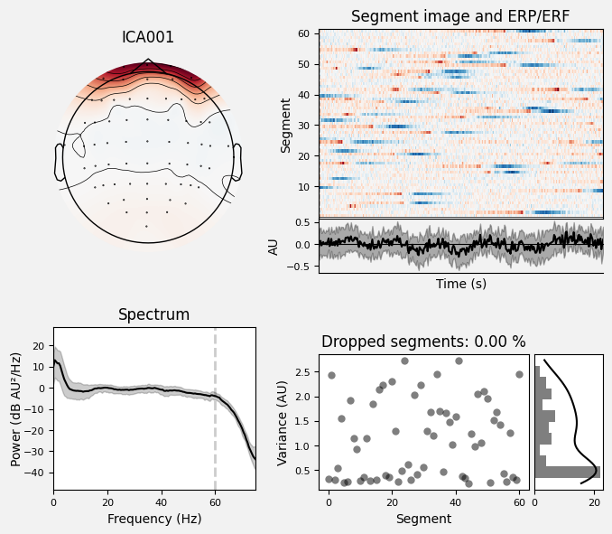 _images/train_network_eeg_1_146.png