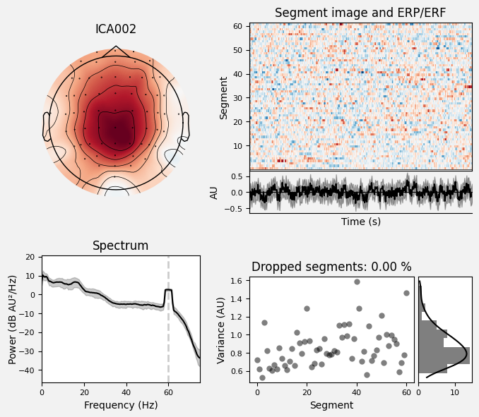_images/train_network_eeg_1_147.png