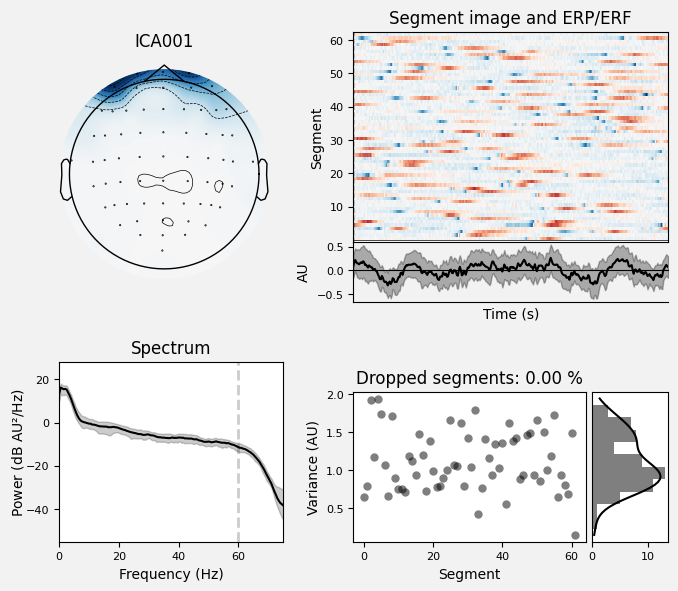 _images/train_network_eeg_1_15.png
