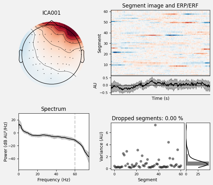 _images/train_network_eeg_1_153.png