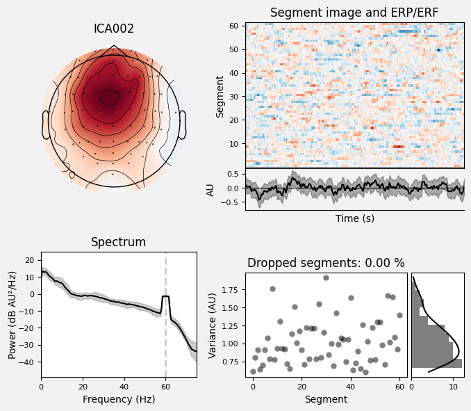 _images/train_network_eeg_1_154.png