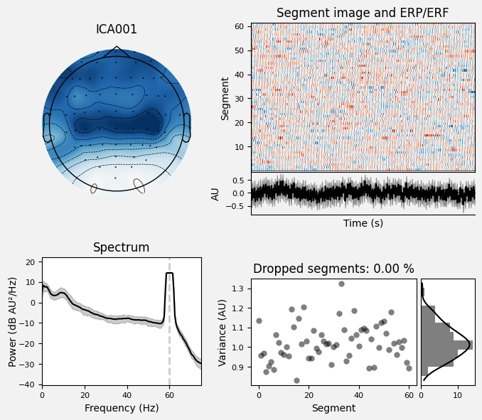 _images/train_network_eeg_1_158.png