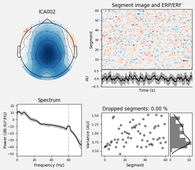 _images/train_network_eeg_1_159.png