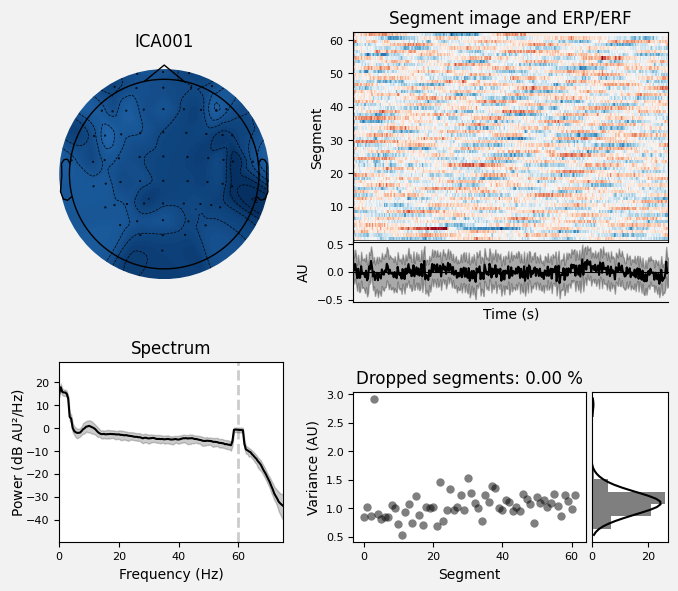 _images/train_network_eeg_1_163.png