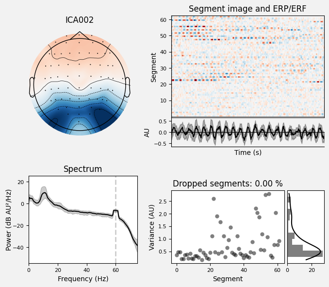 _images/train_network_eeg_1_164.png