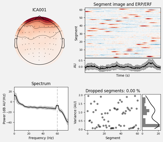 _images/train_network_eeg_1_170.png