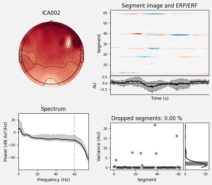 _images/train_network_eeg_1_171.png