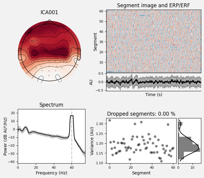 _images/train_network_eeg_1_177.png