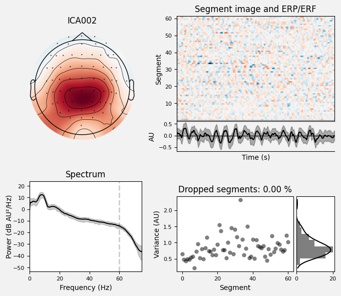 _images/train_network_eeg_1_178.png