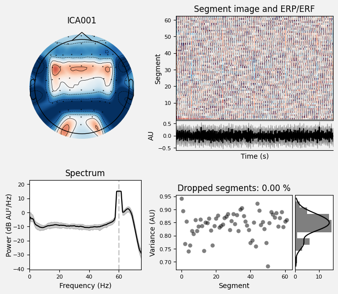 _images/train_network_eeg_1_182.png