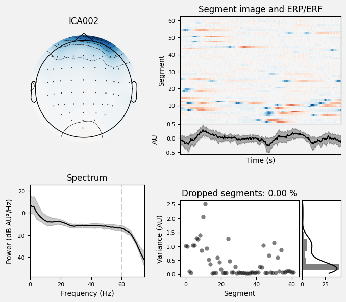 _images/train_network_eeg_1_183.png
