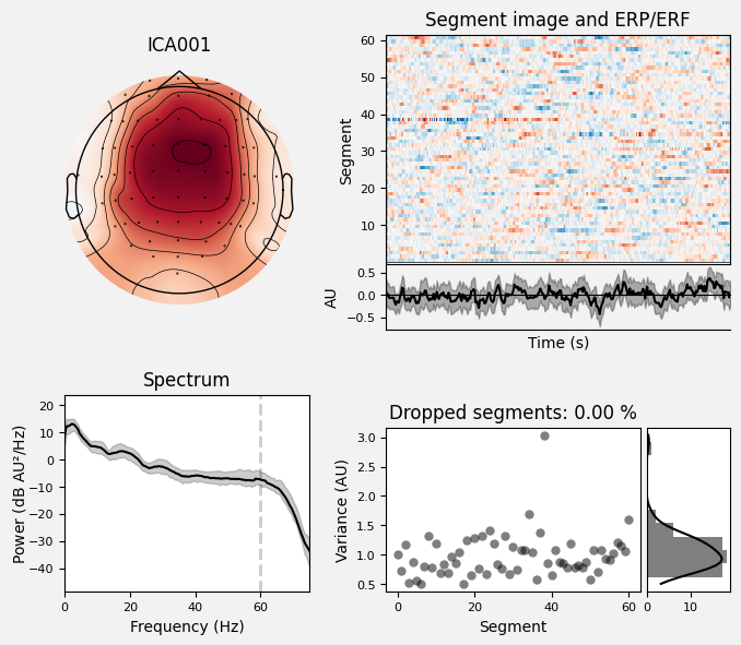 _images/train_network_eeg_1_187.png