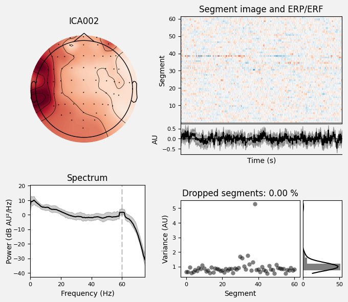 _images/train_network_eeg_1_188.png