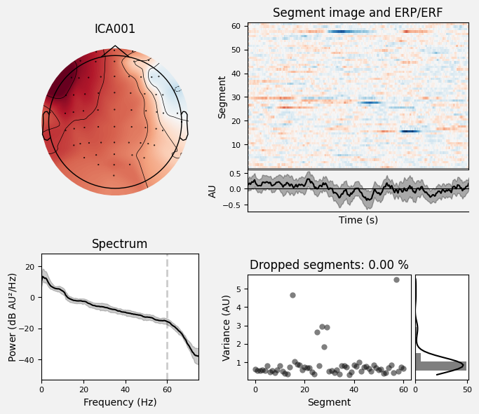_images/train_network_eeg_1_192.png