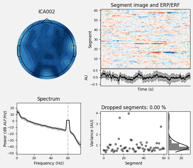 _images/train_network_eeg_1_193.png