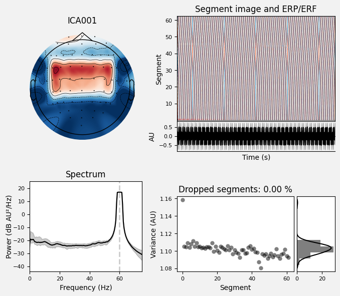 _images/train_network_eeg_1_199.png