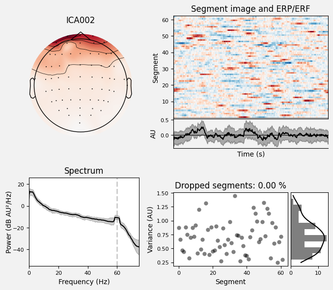 _images/train_network_eeg_1_200.png