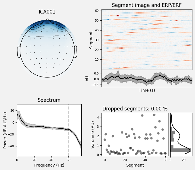 _images/train_network_eeg_1_204.png