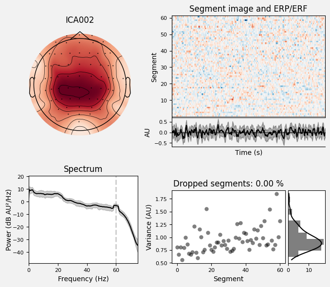 _images/train_network_eeg_1_205.png