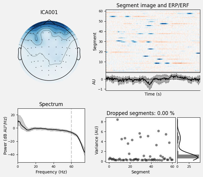 _images/train_network_eeg_1_209.png
