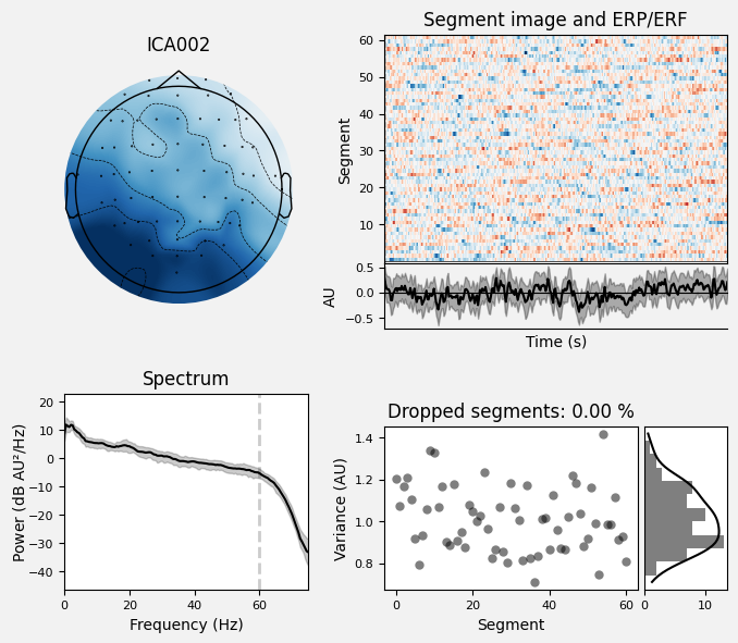 _images/train_network_eeg_1_210.png