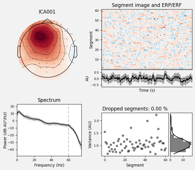 _images/train_network_eeg_1_216.png