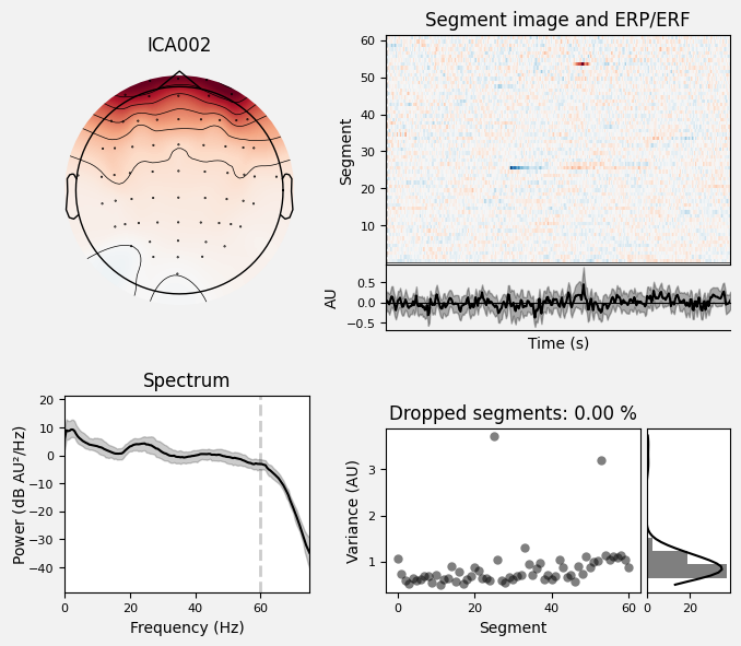 _images/train_network_eeg_1_217.png