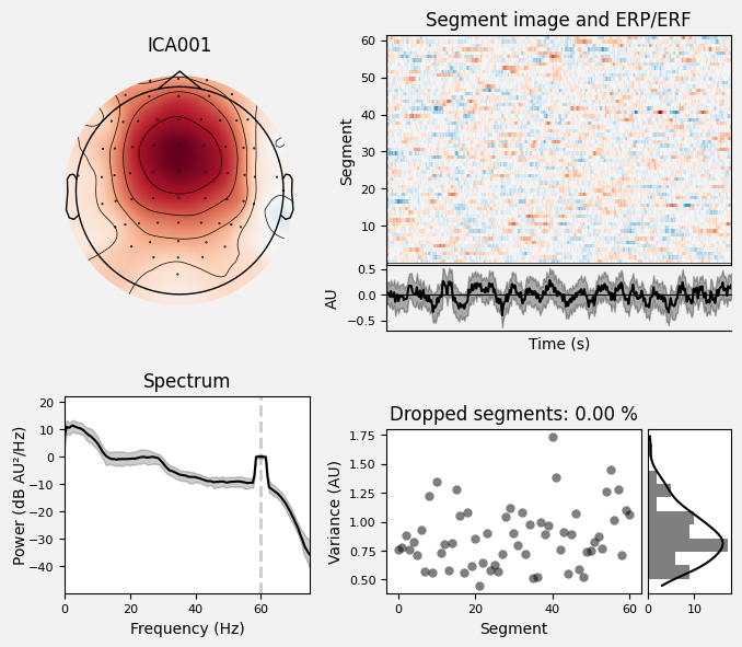 _images/train_network_eeg_1_223.png