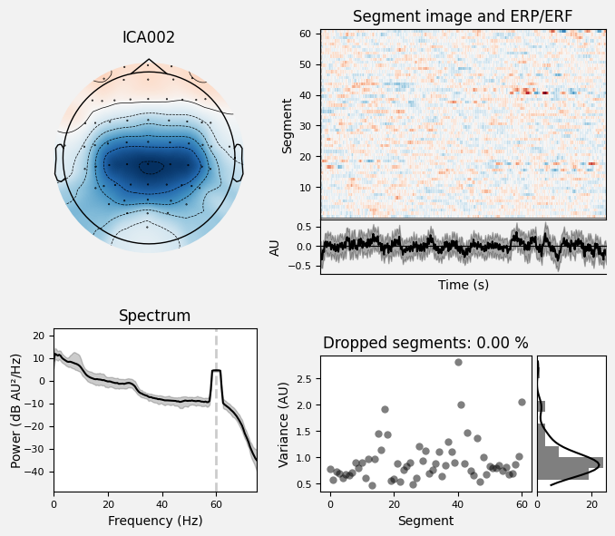 _images/train_network_eeg_1_224.png