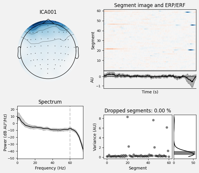 _images/train_network_eeg_1_228.png