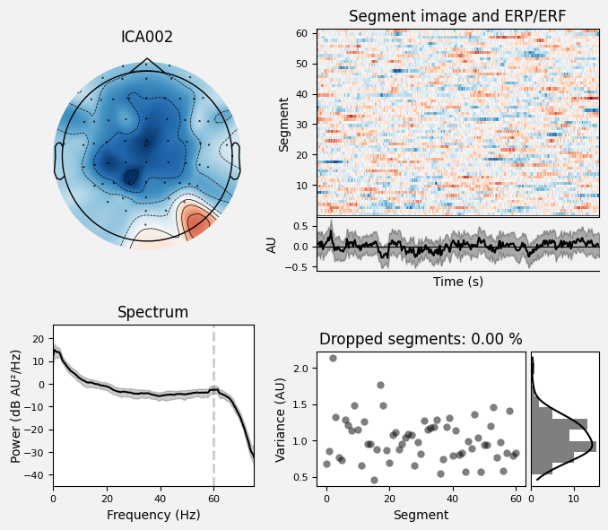 _images/train_network_eeg_1_229.png