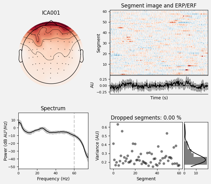 _images/train_network_eeg_1_235.png