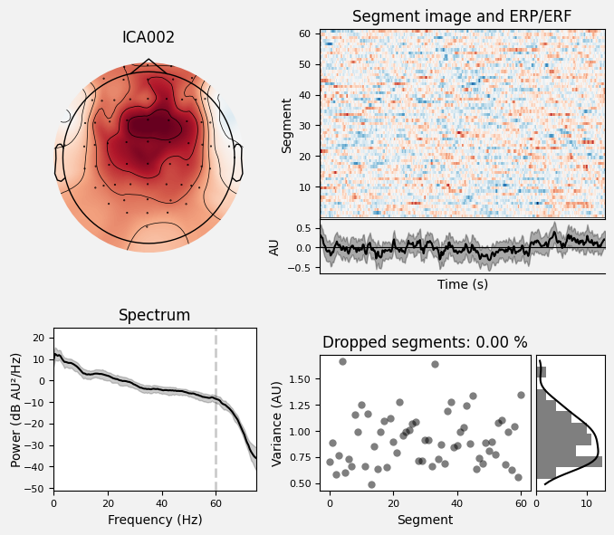 _images/train_network_eeg_1_236.png