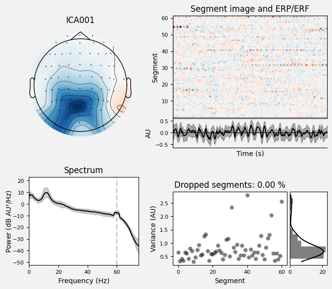 _images/train_network_eeg_1_242.png