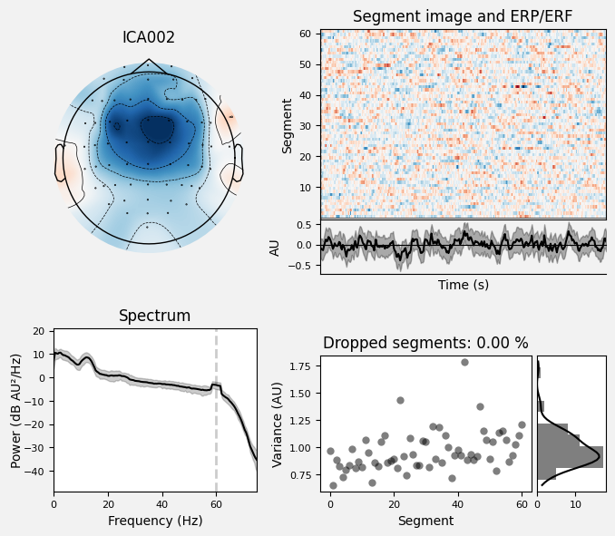 _images/train_network_eeg_1_243.png